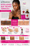 KORMESIC Dark Knuckle whitening Serum